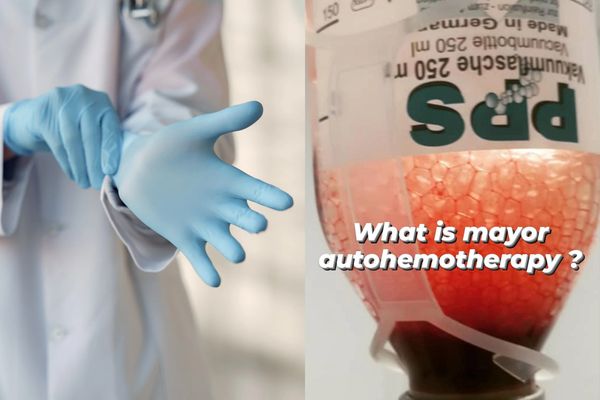 ¿Conoces los beneficios de la Autohemoterapia con Ozono?