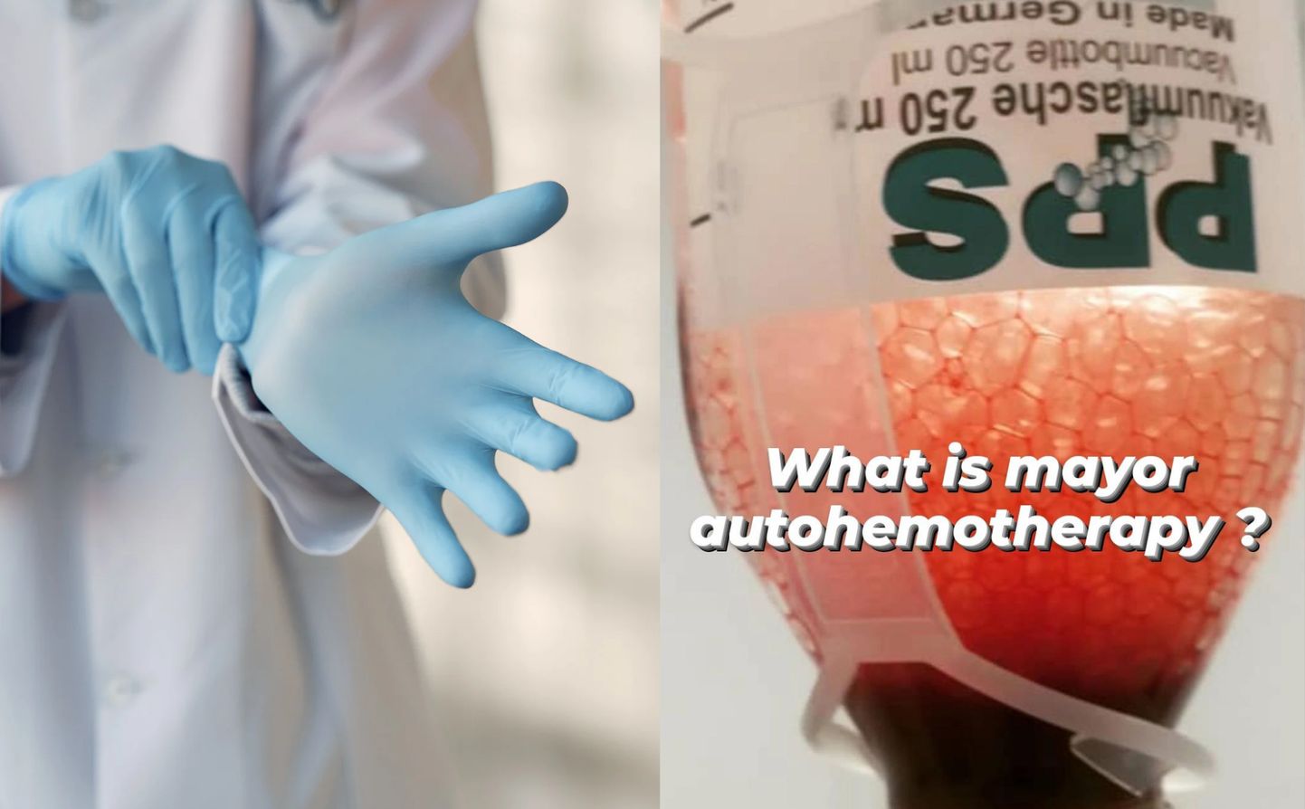 ¿Conoces los beneficios de la Autohemoterapia con Ozono?